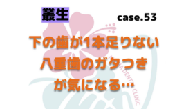 下の歯が1本足りない、八重歯のガタつきが気になる　▶